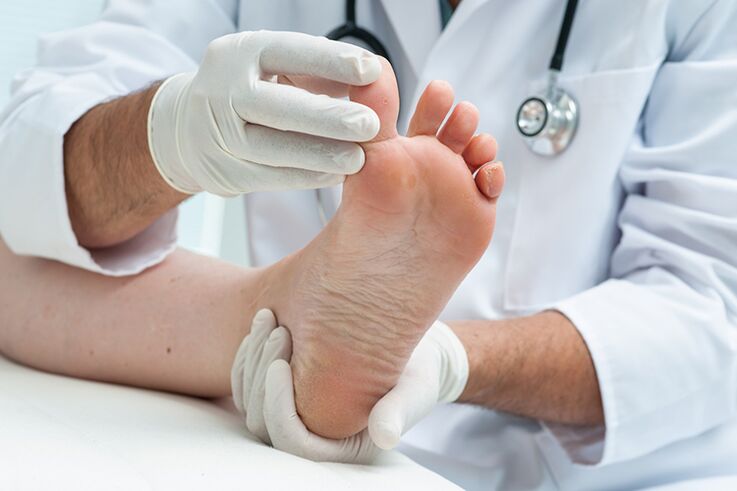 يفحص طبيب الأمراض الجلدية أرجل المريض